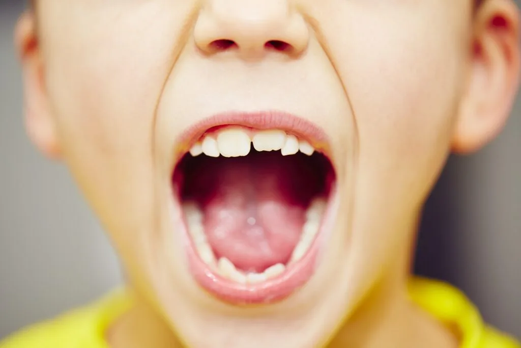 Searching for a kids dentist near you? Dentistry for Children offers gentle, child-friendly dental care in Las Vegas!